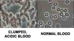 blood image